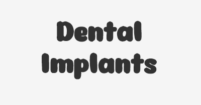 Thumbnail for lifespan of Dental Implants