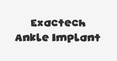 Thumbnail for lifespan of Exactech Ankle Implant