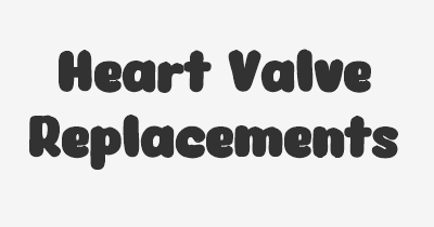 Thumbnail for lifespan of Heart Valve Replacements